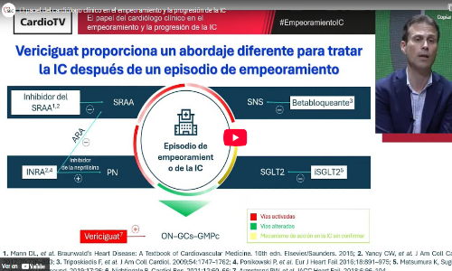 El papel clave del cardiólogo clínico en la progresión y descompensación de la insuficiencia cardiaca: Reflexiones y evidencias recientes